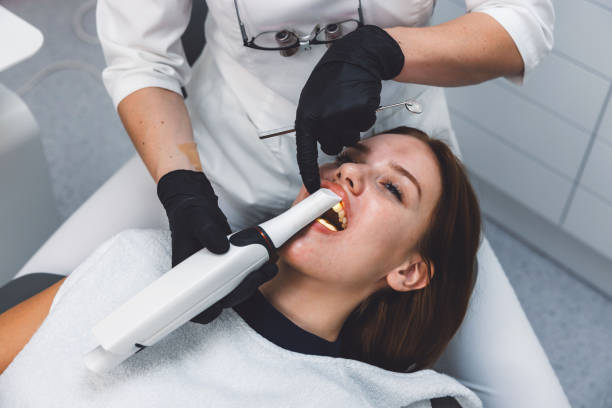 Emergency Dental Filling Replacement in LA