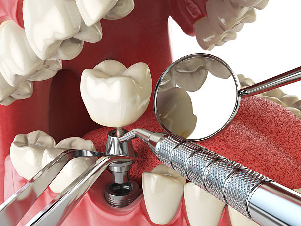 Dentist for Dental Trauma in LA