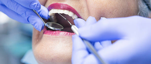 Best Tooth Infection Emergency Dentist  in Bayou Gauche, LA